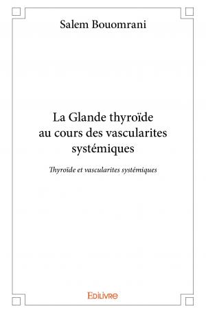 La Glande thyroïde au cours des vascularites systémiques